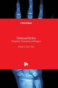 bokomslag Osteoarthritis: Diagnosis, Treatment and Surgery
