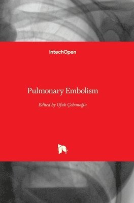 bokomslag Pulmonary Embolism