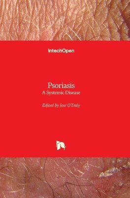 bokomslag Psoriasis: A Systemic Disease