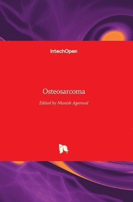 Osteosarcoma 1