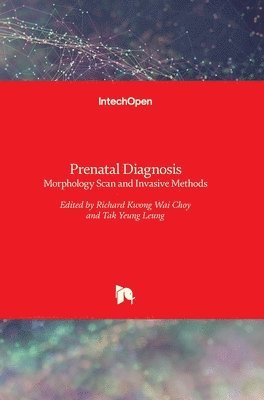 bokomslag Prenatal Diagnosis