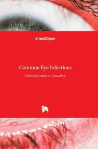 bokomslag Common Eye Infections