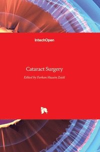 bokomslag Cataract Surgery