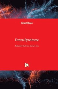 bokomslag Down Syndrome
