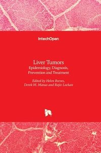 bokomslag Liver Tumors: Epidemiology, Diagnosis, Prevention and Treatment