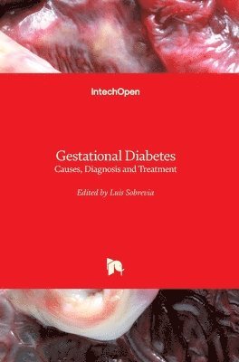 Luis Sobrevia - Gestational Diabetes, Inbunden