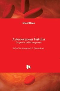 bokomslag Arteriovenous Fistulas: Diagnosis and Management