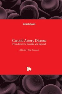 bokomslag Carotid Artery Disease