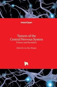 bokomslag Tumors Of The Central Nervous System