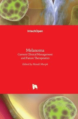 Melanoma 1