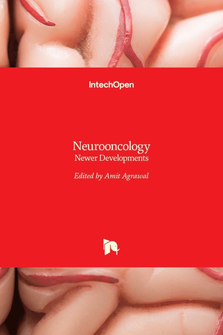 Amit Agrawal - Neurooncology, Inbunden