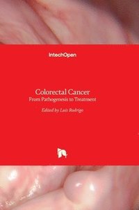 bokomslag Colorectal Cancer