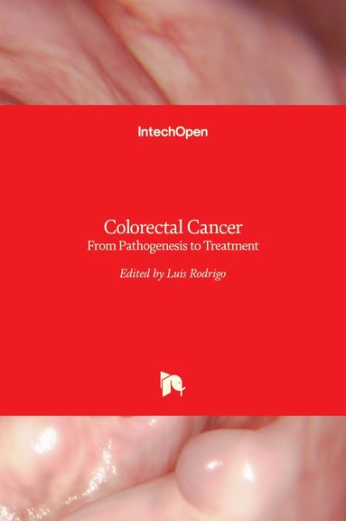Luis Rodrigo - Colorectal Cancer, Inbunden