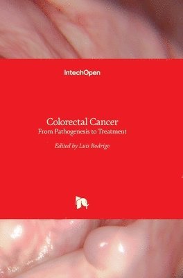 Colorectal Cancer 1