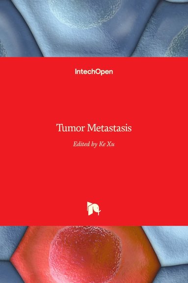 bokomslag Tumor Metastasis