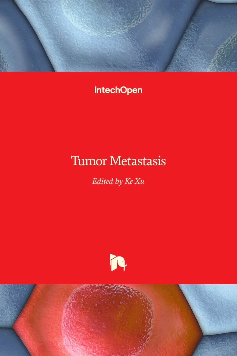 Tumor Metastasis 1