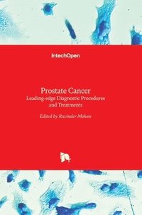 bokomslag Prostate Cancer