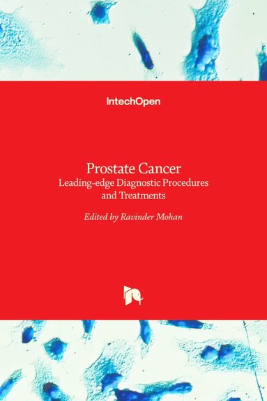 bokomslag Prostate Cancer