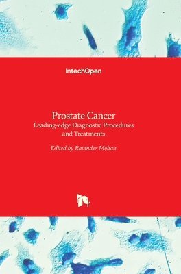 Prostate Cancer 1