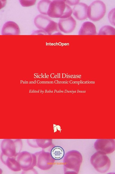 bokomslag Sickle Cell Disease