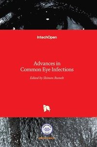 bokomslag Advances in Common Eye Infections