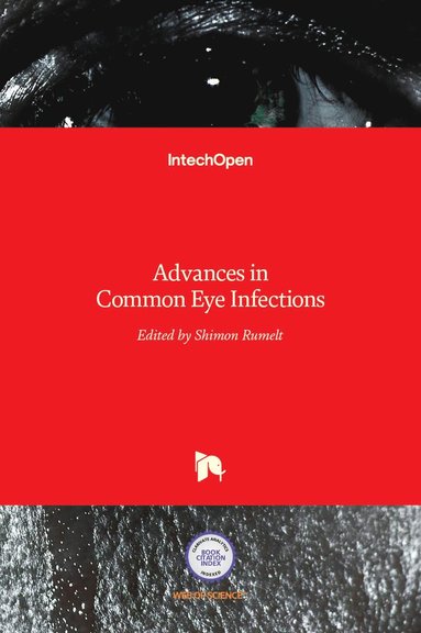 bokomslag Advances in Common Eye Infections