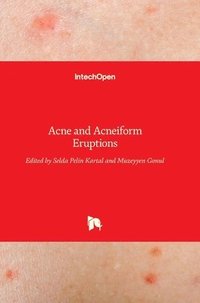 bokomslag Acne and Acneiform Eruptions