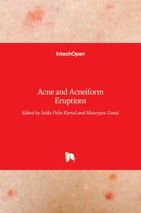 bokomslag Acne and Acneiform Eruptions