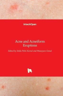 bokomslag Acne and Acneiform Eruptions