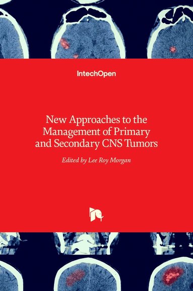 bokomslag New Approaches to the Management of Primary and Secondary CNS Tumors