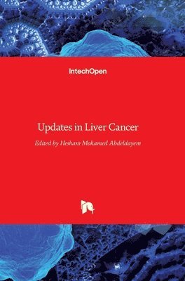 Hesham Mohamed Abdeldayem, Hesham Abdeldayem - Updates in Liver Cancer, Inbunden
