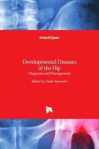 bokomslag Developmental Diseases of the Hip