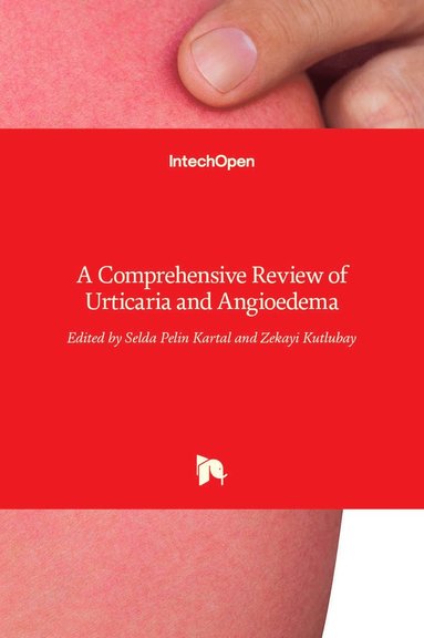 Selda Pelin Kartal, Zekayi Kutlubay - Urticaria and Angioedema, Inbunden