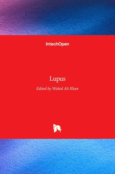 Wahid Ali Khan - Lupus, Inbunden