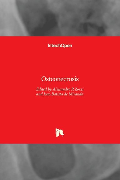 Alessandro R Zorzi, Joao Batista de Miranda - Osteonecrosis, Inbunden