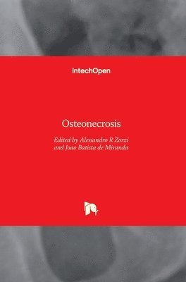 Osteonecrosis 1