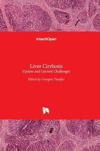 bokomslag Liver Cirrhosis