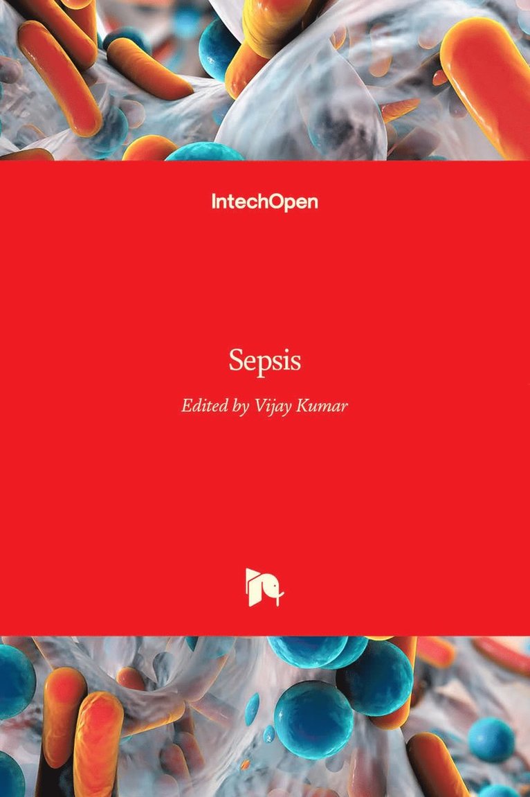 Vijay Kumar - Sepsis, Inbunden