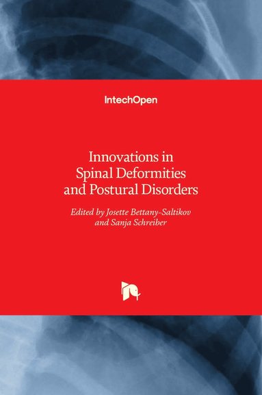 bokomslag Innovations in Spinal Deformities and Postural Disorders