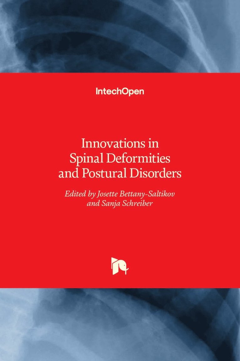 Innovations in Spinal Deformities and Postural Disorders 1