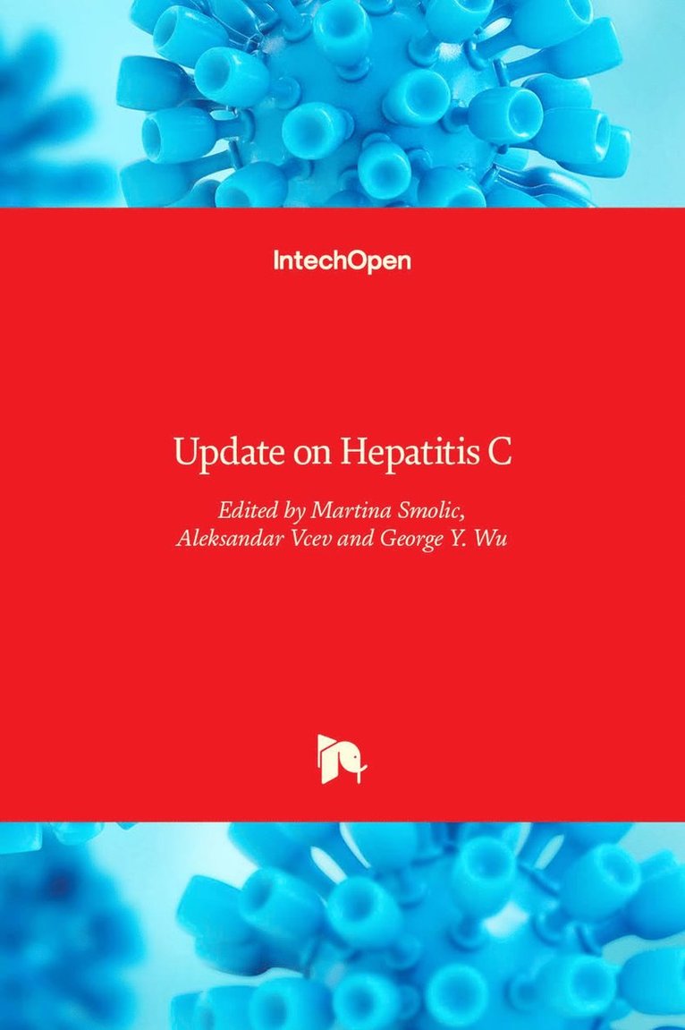 Martina Smolic, Aleksandar Vcev, George Y. Wu, George Wu - Update on Hepatitis C, Inbunden