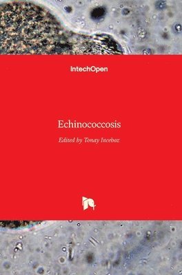 Echinococcosis 1