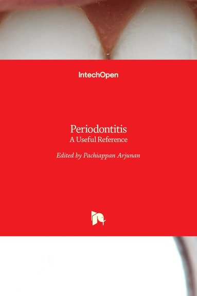 bokomslag Periodontitis