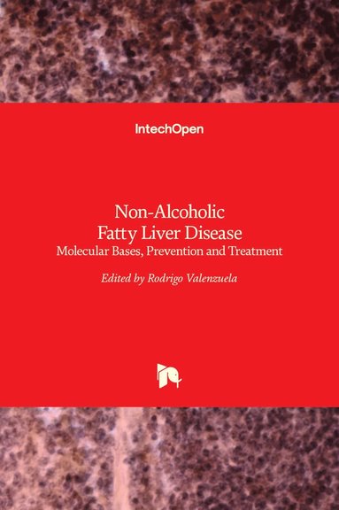 Rodrigo Valenzuela - Non-Alcoholic Fatty Liver Disease, Inbunden