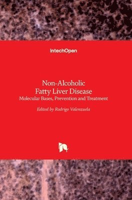 Rodrigo Valenzuela - Non-Alcoholic Fatty Liver Disease, Inbunden