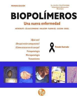 Julio Alberto Zuleta Mora - Biopolimeros: Una nueva enfermedad, Häftad