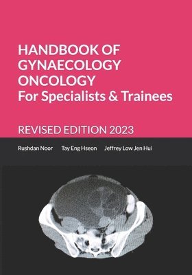 bokomslag Handbook of Gynaecology Oncology for Specialists and Trainees