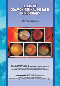 bokomslag The Atlas of Retinal Diseases in Nigerians