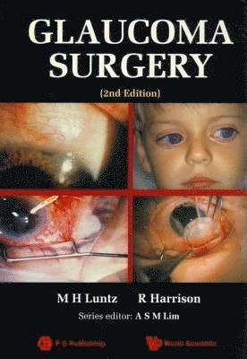 bokomslag Glaucoma Surgery (2nd Edition)