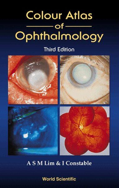 Arthur S M Lim, Ian J Constable - COLOUR ATLAS OF OPHTHALMOLOGY (THIRD EDITION), Inbunden